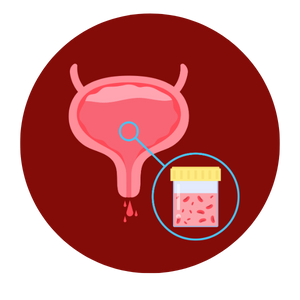 Symptoms of urinary tract disordes