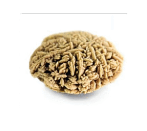 Calcium Stones