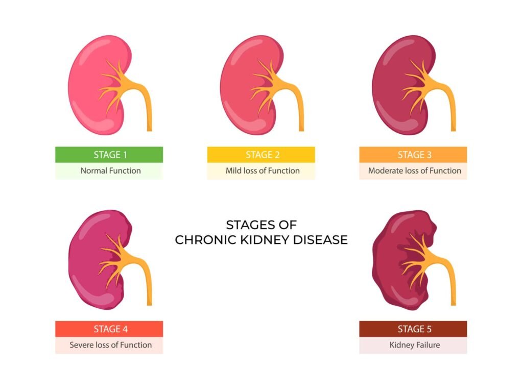 Treatment for Chronic Kidney Disease