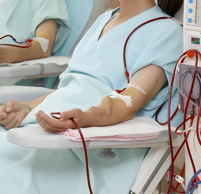 Kidney Dialysis