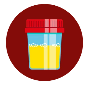 treatment for Chronic Kidney Disease