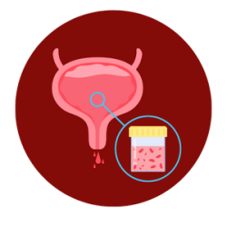 Symptoms of urinary tract disordes