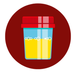 treatment for Chronic Kidney Disease