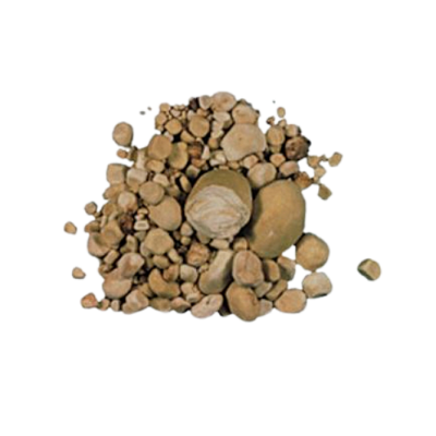 Uric Acid Stones
