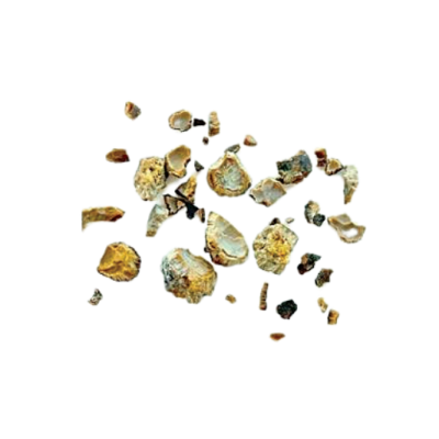 Cystine stones