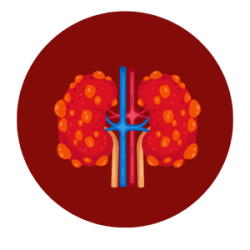Kidney transplant in mumbai