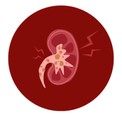 Treatment for Electrolyte and Fluid Imbalances