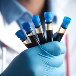 Treatment for Chronic kidney disease