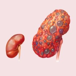 Dialysis treatment in mumbai