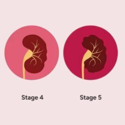 Dialysis treatment